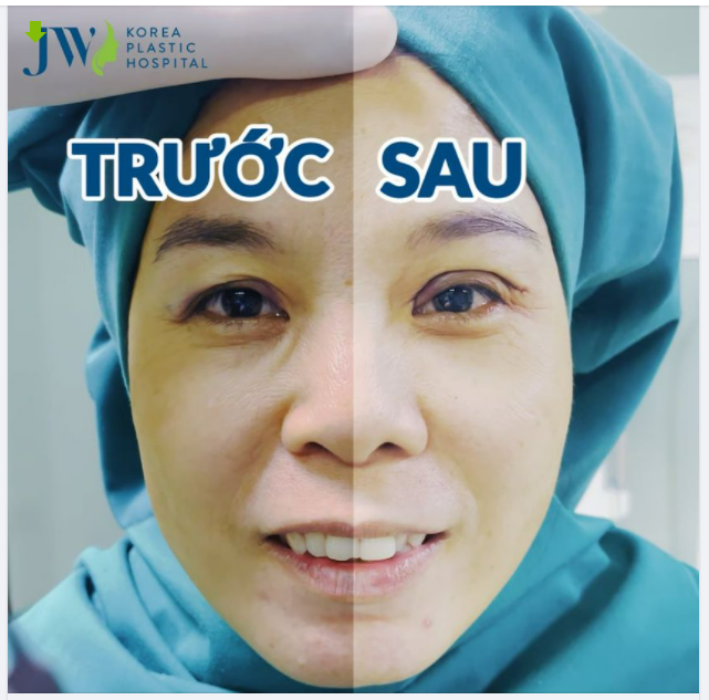 ​​​​​​​BÍ QUYẾT HỒI SINH ĐÔI MẮT U SẦU