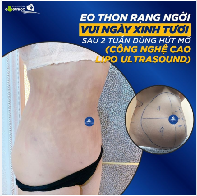 BỨC TÂM THƯ THAY ĐỔI VẬN MỆNH CUỘC ĐỜI CÔ GÁI SAU KHI PHẪU THUẬT HÀM HÔ