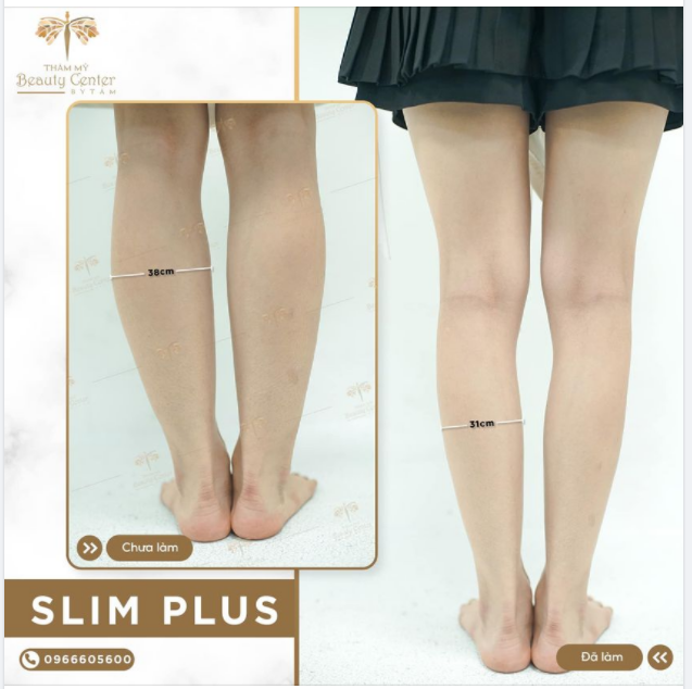 BUỒN PHIỀN BẮP CHÂN TO- ĐỪNG LO TẤM GIÚP BẠN