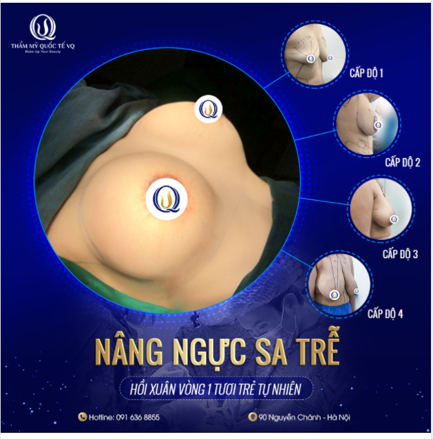 CÁC CẤP ĐỘ CHẢY XỆ CỦA NG ỰC CẦN ĐƯỢC CẢI THIỆN