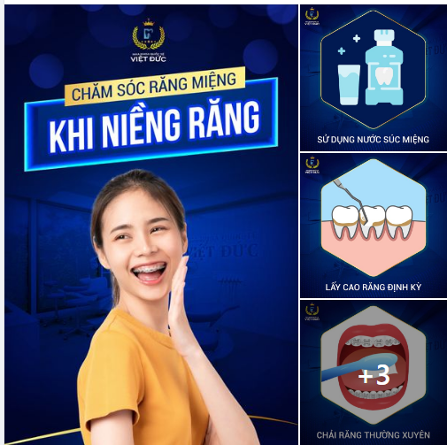 CÁCH CHĂM SÓC RĂNG MIỆNG KHI NIỂNG RĂNG