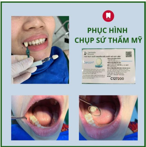 CÁI RĂNG - CÁI TÓC LÀ GÓC CON NGƯỜI!  Bởi vậy, khi có bất gì về răng, cần nhanh chóng điều trị kịp thời.