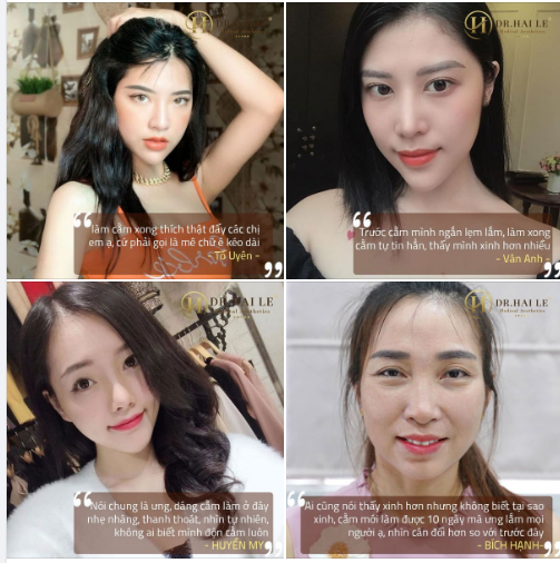 CẰM NGẮN, CẰM LẸM. PHẢI LÀM SAO