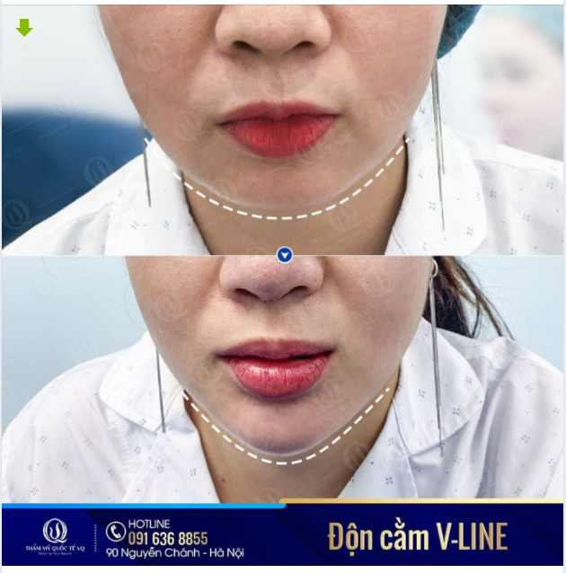 CẰM THON GỌN - GIỮA TRỌN SẮC XUÂN
