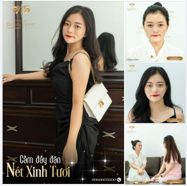 Cằm tròn đầy liệu có khiến bạn xinh hơn