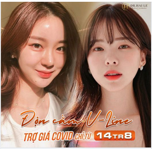 Cằm xinh - Ngắm góc mặt nào cũng xinh