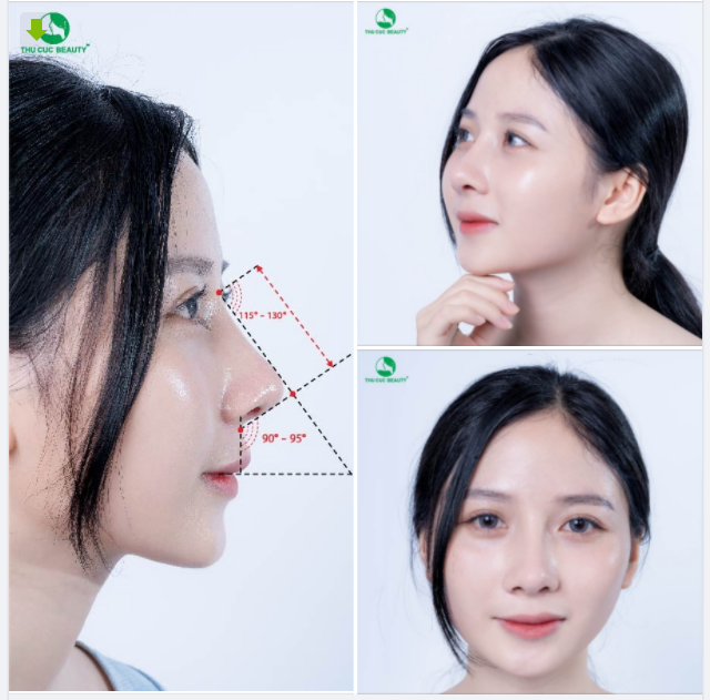 Càng ngắm càng mê dáng mũi cao thon - Đẹp hoàn hảo mọi góc nhìn