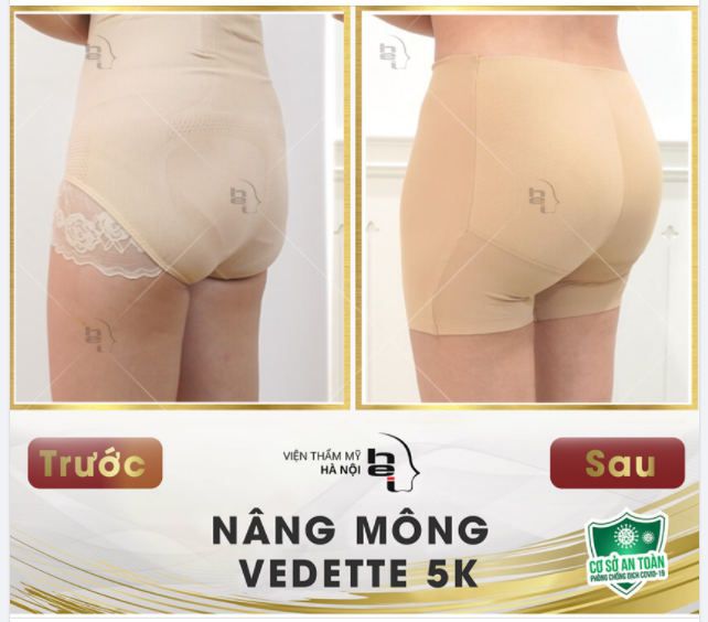 CĂNG THẬT CĂNG - MẨY THẬT MẨY VỚI NÂNG V3 VEDETTE 5K