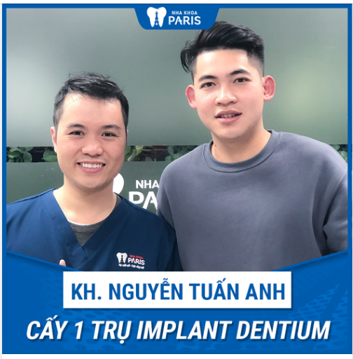 Case Trồng Răng Số 352 - Tút Lại Phong Độ Cho Soái Ca