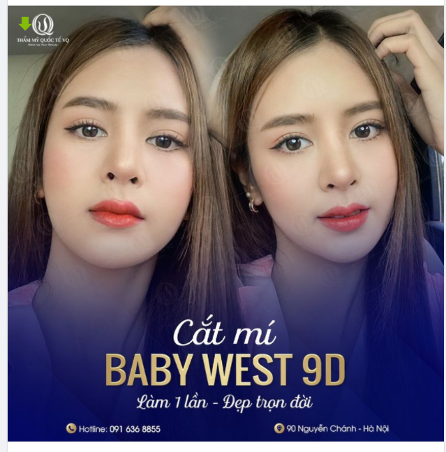 CẮT MÍ BABY WEST 9D - LỘT XÁC TỨC THÌ - XINH ĐẸP BẤT NGỜ
