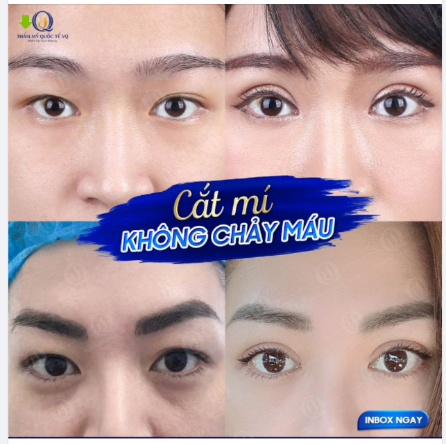 CẮT MÍ - CHỈ ĐẸP VÀ AN TOÀN KHI LÀM ĐẸP ĐÚNG ĐỊA CHỈ