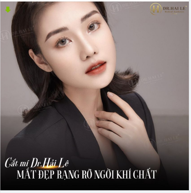 Cắt mí Dr.Hải Lê - Mắt đẹp rạng rỡ ngời khí chất