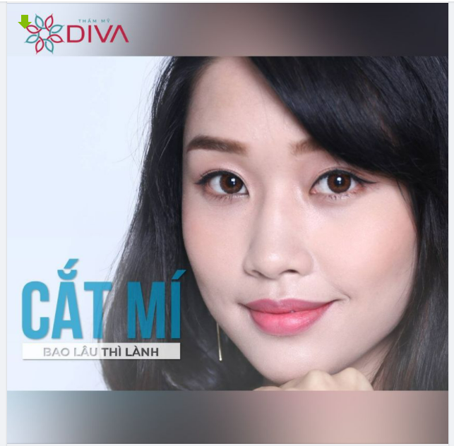 CẮT MÍ IDOVE BAO LÂU THÌ LÀNH ?
