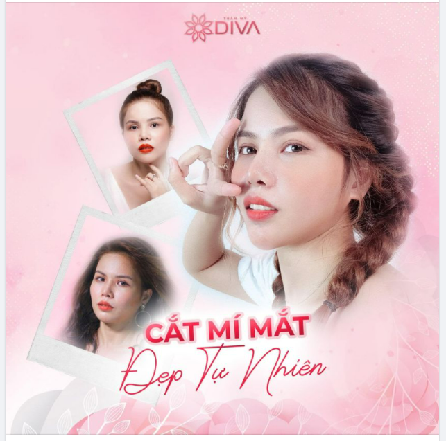 CẮT MÍ MẮT IDOVE: MÍ ĐỀU, MẮT ĐẸP TỰ NHIÊN