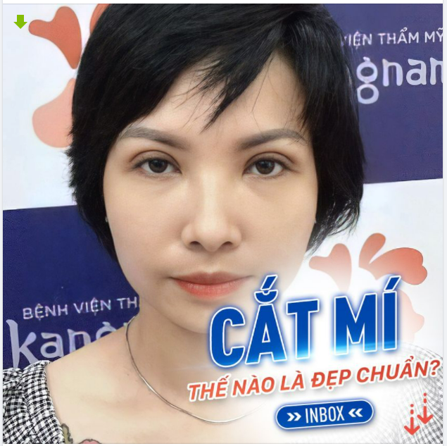 Cắt mí như nào để mắt đẹp chuẩn tỷ lệ???