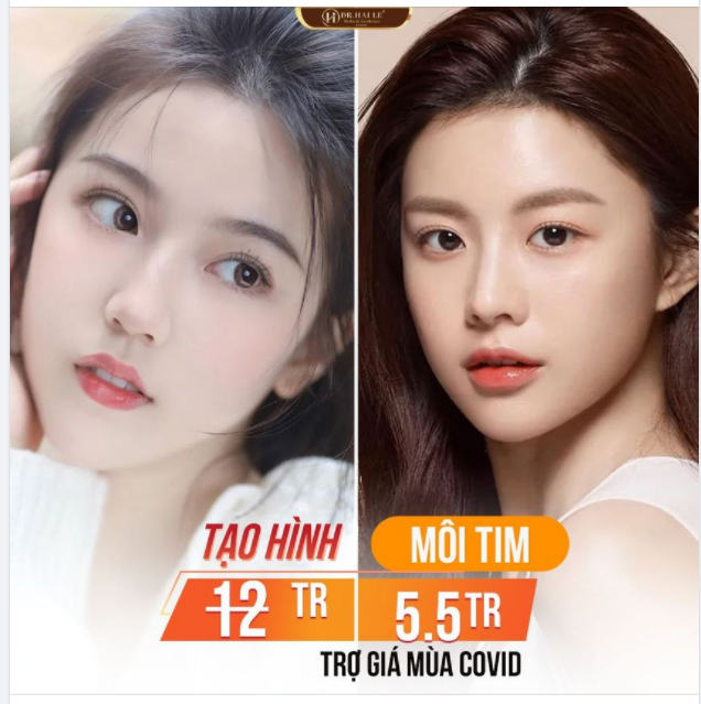 Cắt môi trái tim - Tạo hình môi đẹp - quyến rũ "vạn người mê"