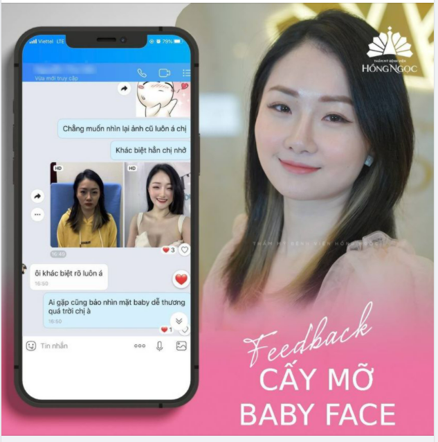 CẤY MỠ BABY FACE: XÓA SẠCH GIÀ NUA - XUA TAN LÕM HÓP
