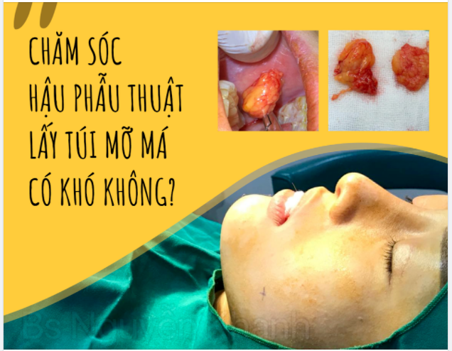 CHĂM SÓC HẬU PHẪU THUẬT LẤY TÚI MỠ MÁ CÓ KHÓ KHÔNG?