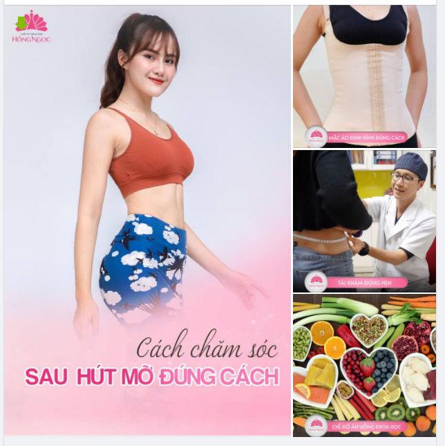 CHĂM SÓC SAU HÚT MỠ BỤNG ĐÚNG CÁCH
