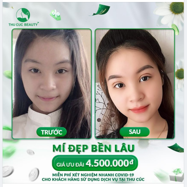 CHỈ KHOẢNG 15' THỰC HIỆN CÓ NGAY NẾP MÍ ĐẸP BỀN LÂU