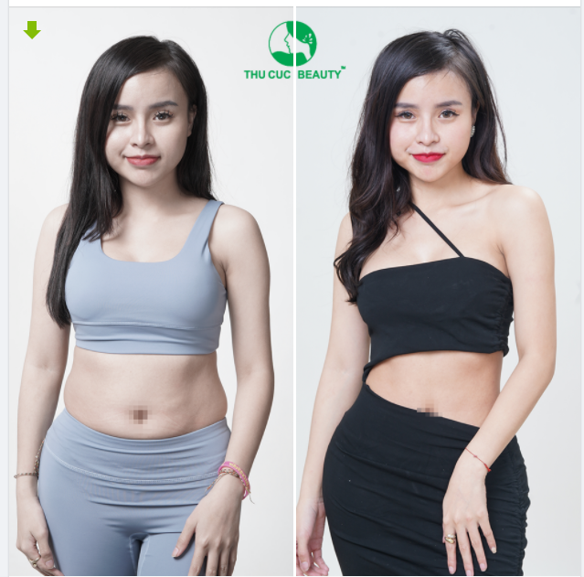 CHỈ KHOẢNG 60 PHÚT THỰC HIỆN HIỆU QUẢ BẰNG MẤY THÁNG ĂN KIÊNG, TẬP LUYỆN