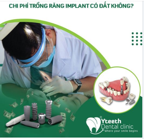 CHI PHÍ TRỒNG RĂNG IMPLANT CÓ ĐẮT KHÔNG