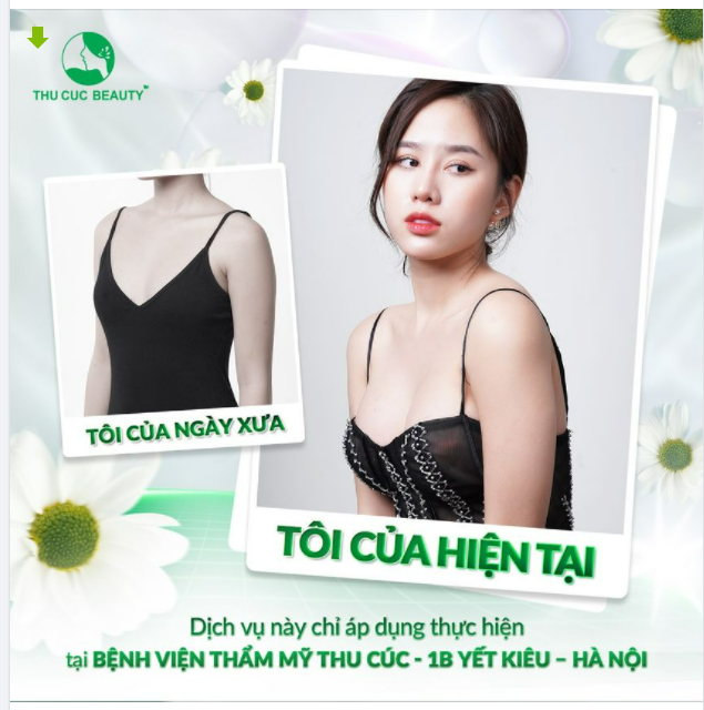 CHỈ TỪ 38.023 TRIỆU NÂNG CẤP V1 - LỘT XÁC DIỆN MẠO
