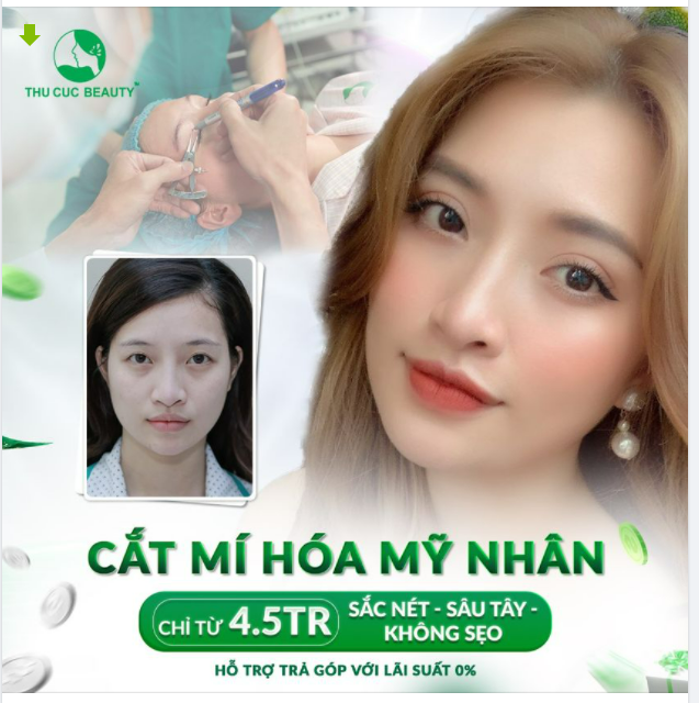 CHỈ TỪ 4.5 TRIỆU  "HÓA" MỸ NHÂN NHỜ CẮT MÍ