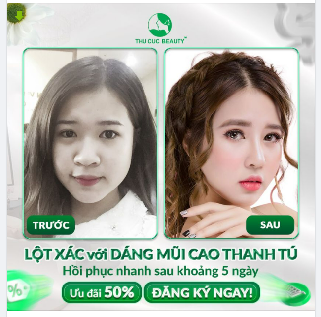 CHỈ TỪ 8.5 TRIỆU  LỘT XÁC VỚI DÁNG MŨI CAO THANH TÚ