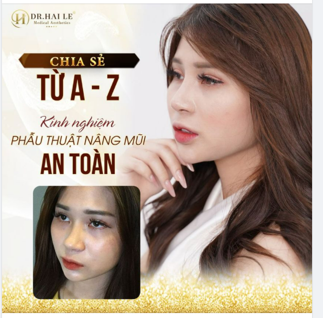 CHIA SẺ TỪ A-Z KINH NGHIỆM THẨM MỸ MŨI (PHẦN 1)