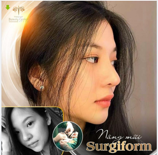 CHIẾC MŨI TẸT KHIẾN NÀNG TỰ TI NAY ĐÃ TRỞ THÀNH ĐIỂM VÀNG TRÊN GƯƠNG MẶT