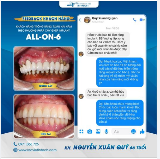 CHỌN TRỒNG RĂNG TẠI NHA KHOA LẠC VIỆT INTECH - CHỌN RĂNG KHỎE ĂN NHAI TỚI SUỐT ĐỜI