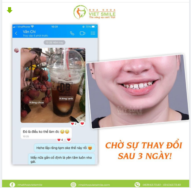 CHUẨN BỊ GÌ TRƯỚC KHI LÀM RĂNG SỨ?