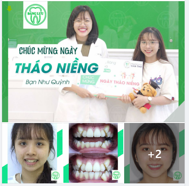 CHÚC MỪNG NGÀY THÁO NIỀNG!