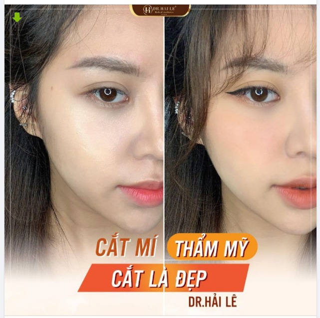 Chụp góc nào thần thái cũng đẹp, nhất là đôi mắt.