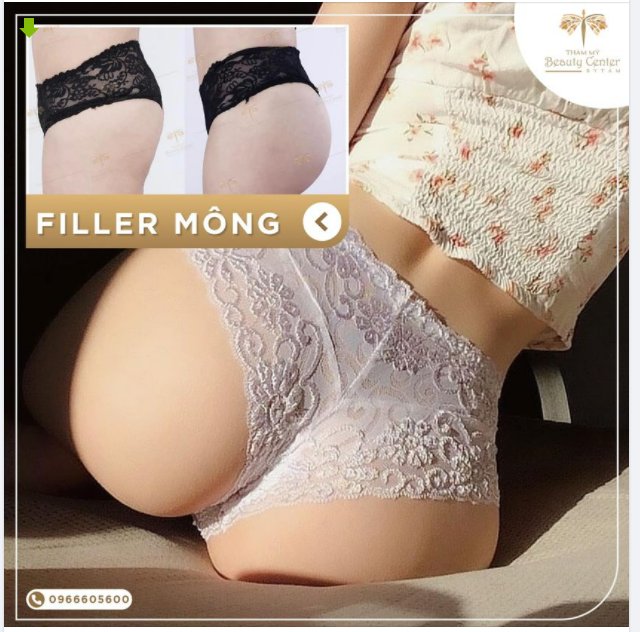 CÓ HAY KHÔNG NÊN FILLER MÔNG