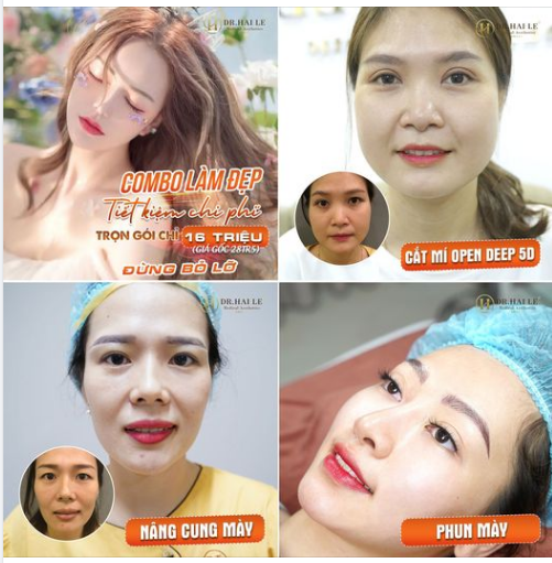 CƠ HỘI VÀNG LÀM ĐẸP VỚI SIÊU ƯU ĐÃI THÁNG 7