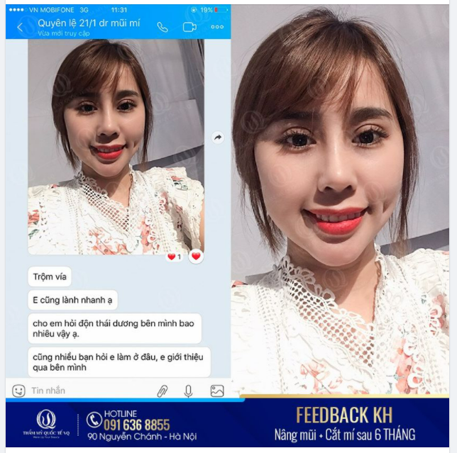 Combo mũi mí - Trọn vẹn từng đường nét