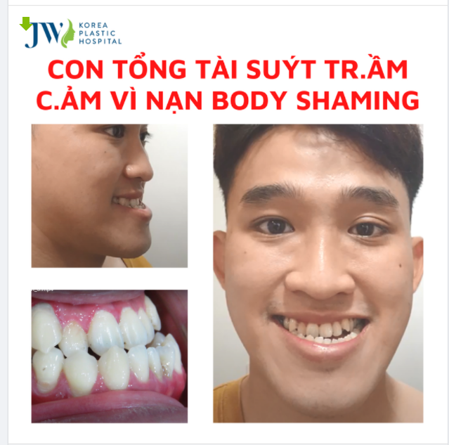CON TỔNG TÀI suýt TRẦM CẢM vì nạn BODY SHAMING
