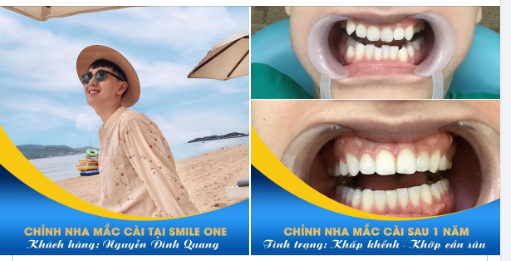 ĐÃ NIỀNG LÀ PHẢI ĐẸP