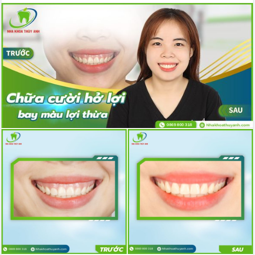 ĐĂNG KÝ LIỀN TAY HẾT BAY CƯỜI HỞ LỢI SALE ĐẾN 40% CHO THÁNG 7