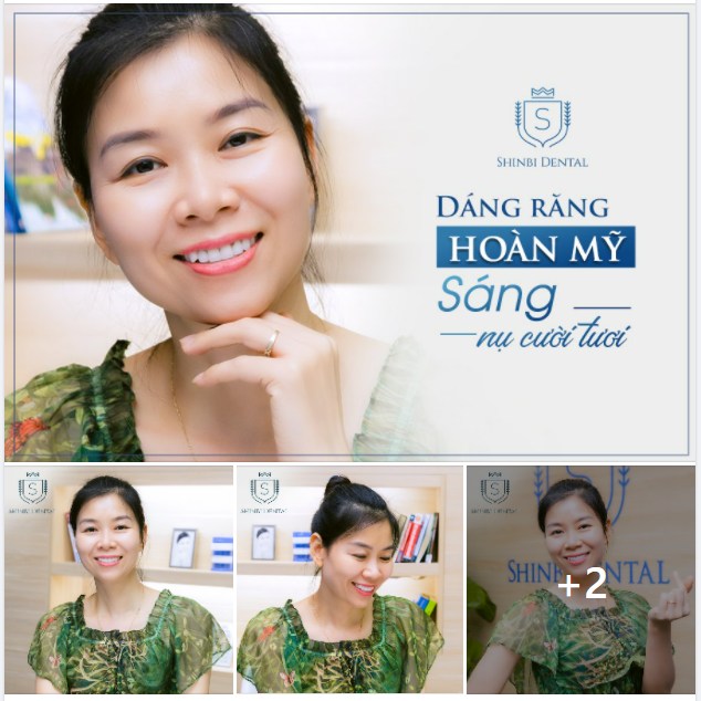Dáng răng hoàn mỹ sáng nụ cười tươi cùng khách hàng Lan Anh