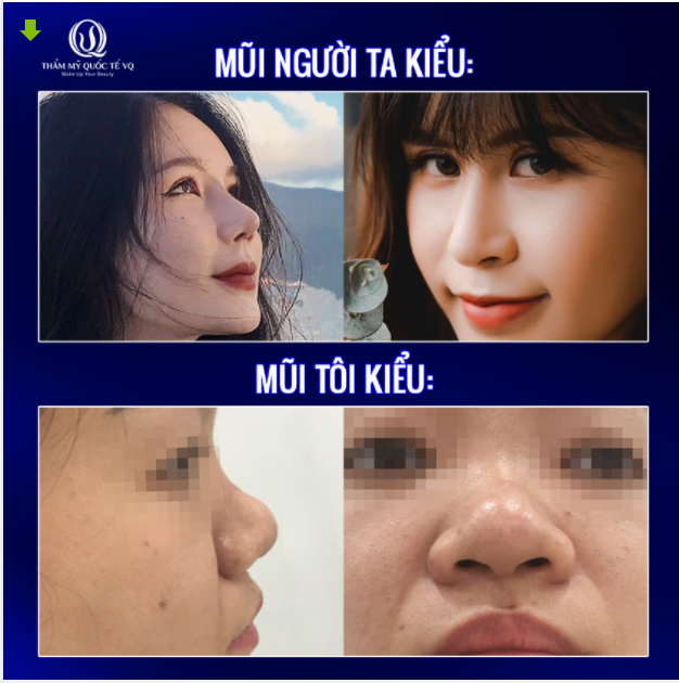 Để “mũi người ta” không còn là ước mơ xa vời