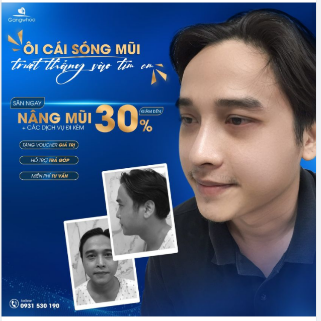 DEAL HÈ RỰC RỠ - RẠNG RỠ NÂNG MŨI