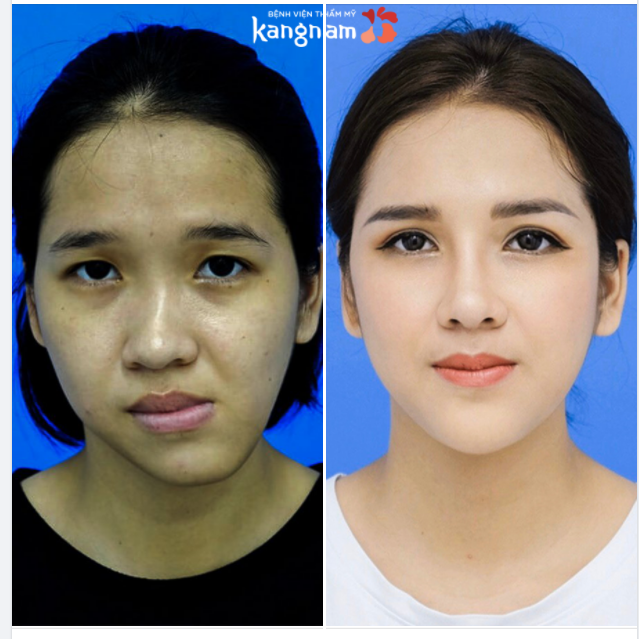 Đẹp chất HÀN QUỐC - Chi phí Việt cùng Kangnam
