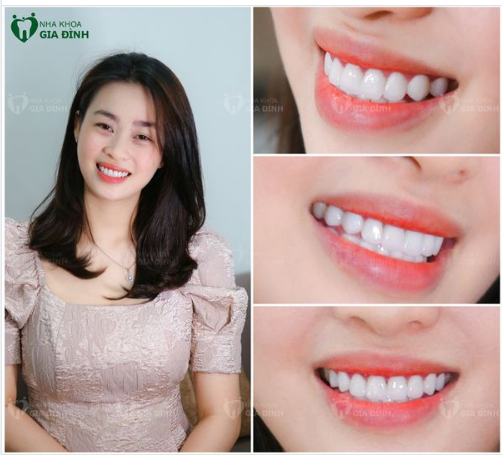 ĐẸP TỰ NHIÊN NHƯNG KHÔNG TỰ NHIÊN MÀ ĐẸP