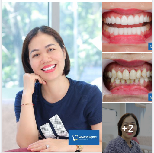 Đi đâu mà vội mà vàng - dừng chân đứng lại một hàng đẹp xinh
