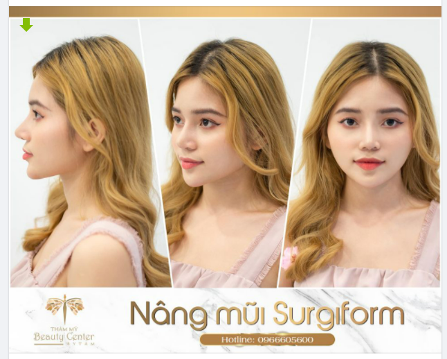 Đi tìm dáng mũi không góc chết!