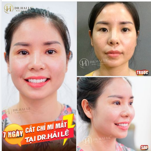 ĐIỂM 10 CHO CHẤT LƯỢNG
