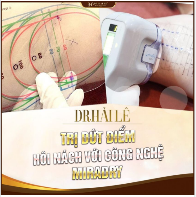 ĐIỀU TRỊ DỨT ĐIỂM HÔI NÁCH VỚI CÔNG NGHỆ MIRADRY Ở DR.HẢI LÊ BÁC SĨ HIỂU ĐÚNG BỆNH - CHỮA ĐÚNG CÁCH - SẠCH “RAU MÙI”